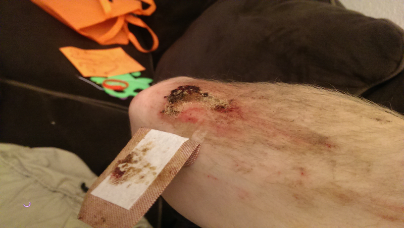 Illustration for article titled Bike crash aftermath pics, blood warning